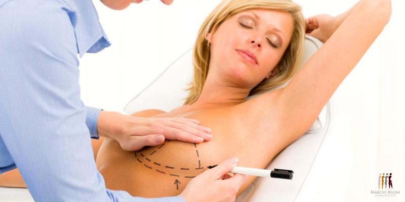 Você conhece os diferentes tipos de cirurgia na mama?